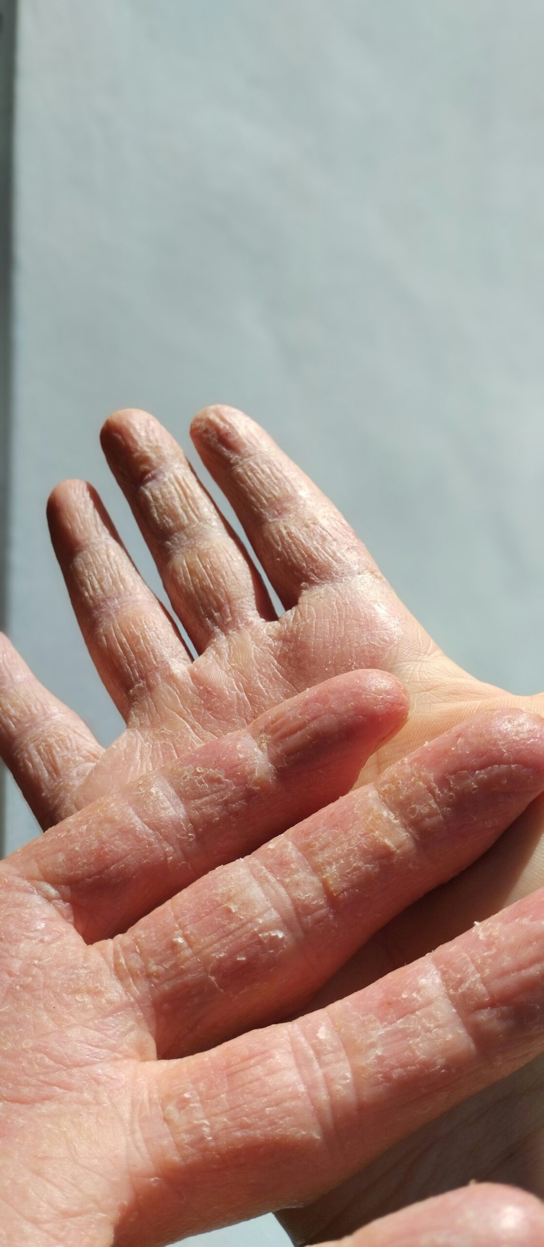 How to Treat Dry Skin Naturally Overnight